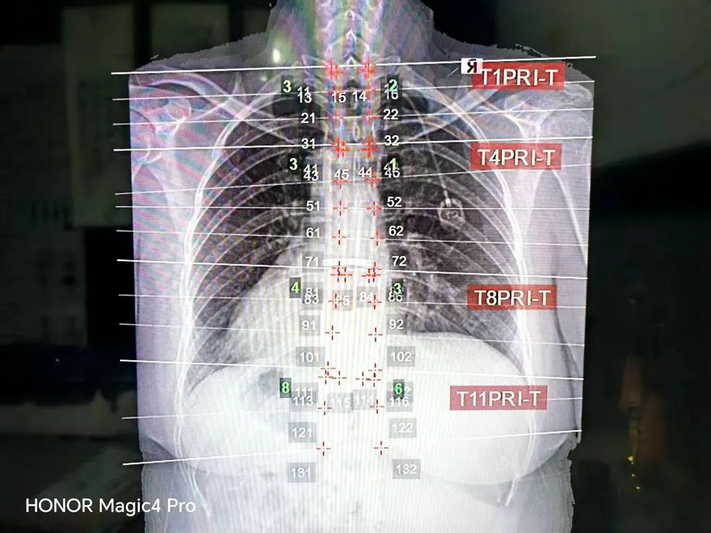 颈椎、胸椎、腰椎矫正方案.jpg